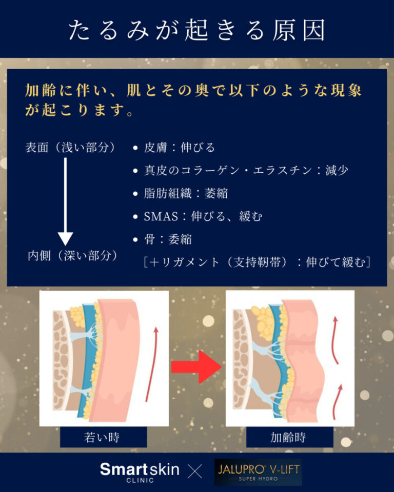 JalPro (Super Hydro) [Tightening Injection] | Smart Skin Clinic ...