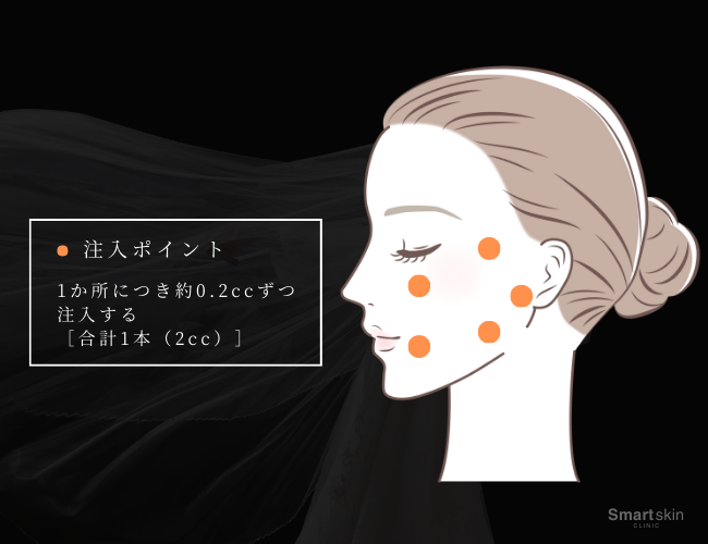 Facial Treatment Points