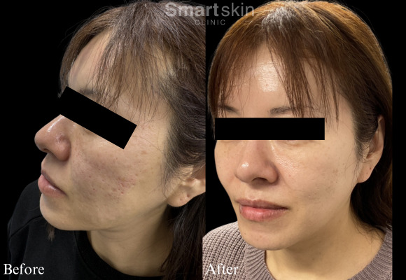 Jubeluk skin quality improvement case (3)