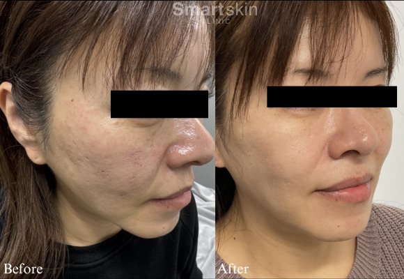 Jubeluk skin quality improvement case (2)