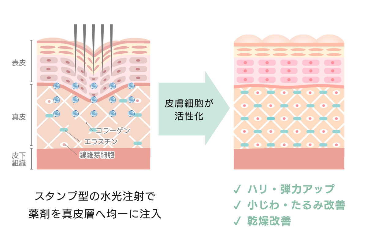 「普魯里亞密實」對肌膚作用的圖解說明