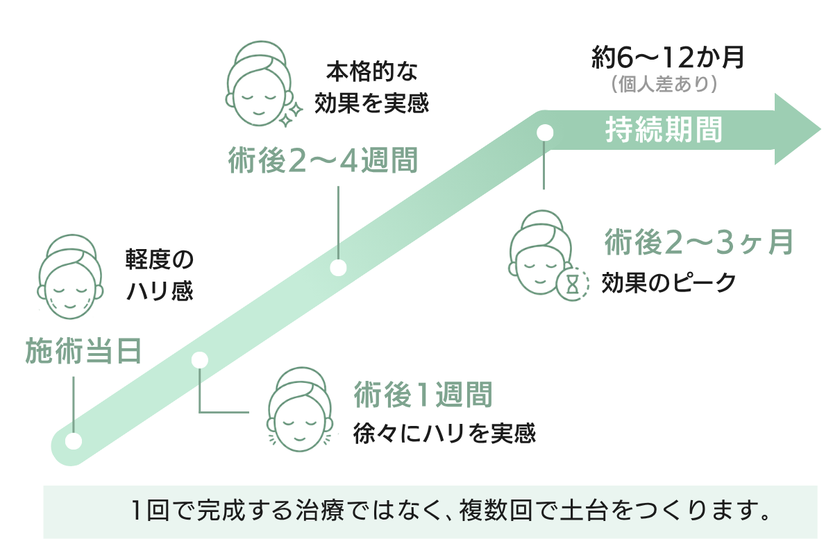 圖解：感受普魯里亞絲綢效果的時機（施術當日・1週・2～4週・2～3個月）及其持續時間
