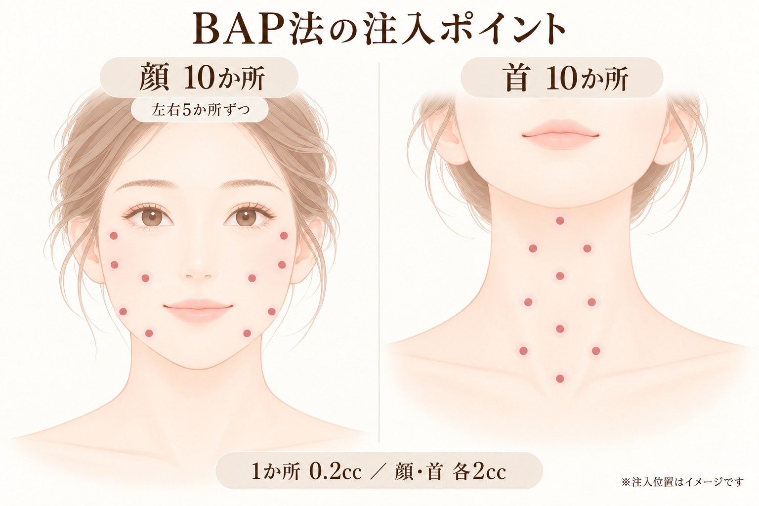 BAP法の注入ポイント 顔10か所・首10か所